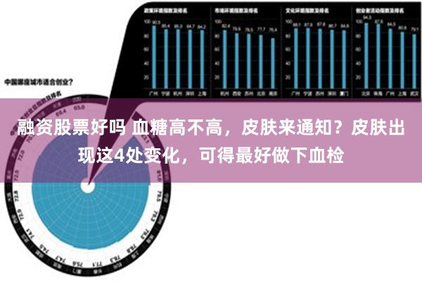 融资股票好吗 血糖高不高，皮肤来通知？皮肤出现这4处变化，可得最好做下血检